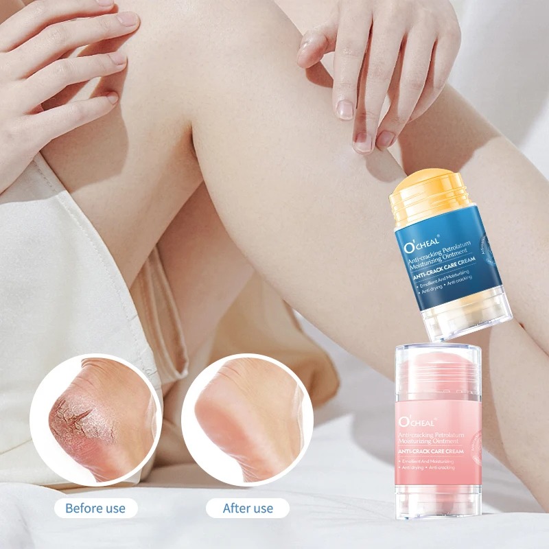ครีมทาเท้าป้องกันรอยแตกสำหรับเ - Heels บทวิจารณ์และราคา